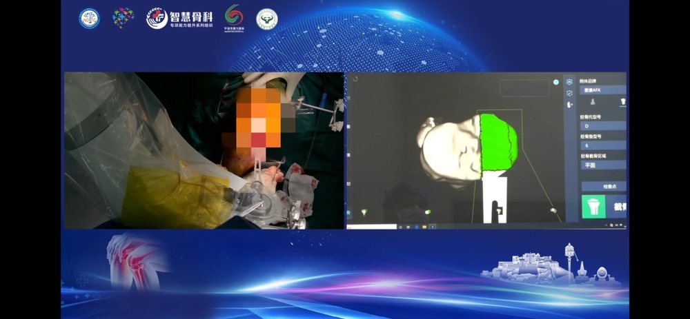 甬藏携手智绘健康蓝图 宁波市六院联动国家临床中心赋能比如医疗(图1)