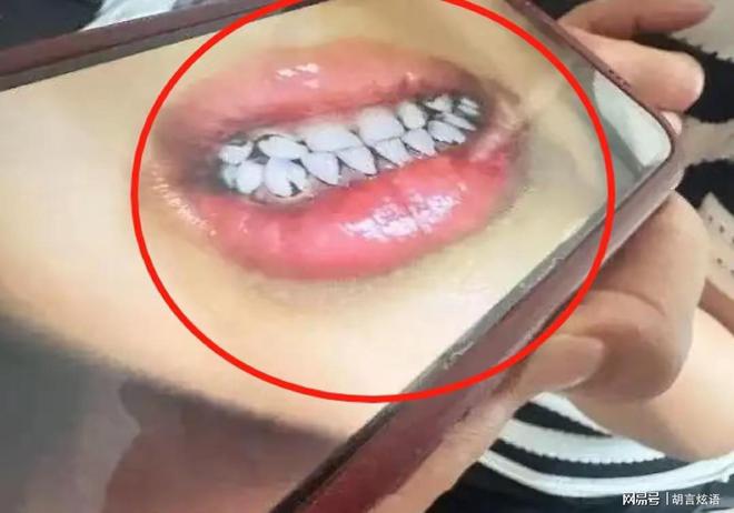 甘肃天水幼儿园铅中毒应该不是故意投毒而是不知添加剂内含铅(图1)