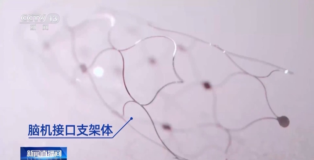 我国脑机接口技术走向临床 受试者体验如何？(图3)