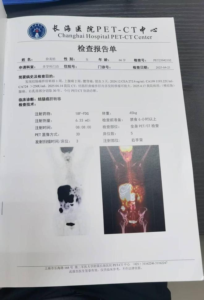 治疗延误酿悲剧低温舱里的母爱冷冻不是幻想是儿子最后的坚持(图6)