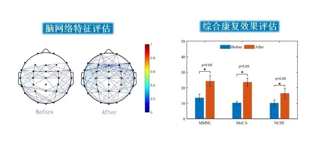 西安高新区企业臻泰智能再获医疗器械注册证(图2)